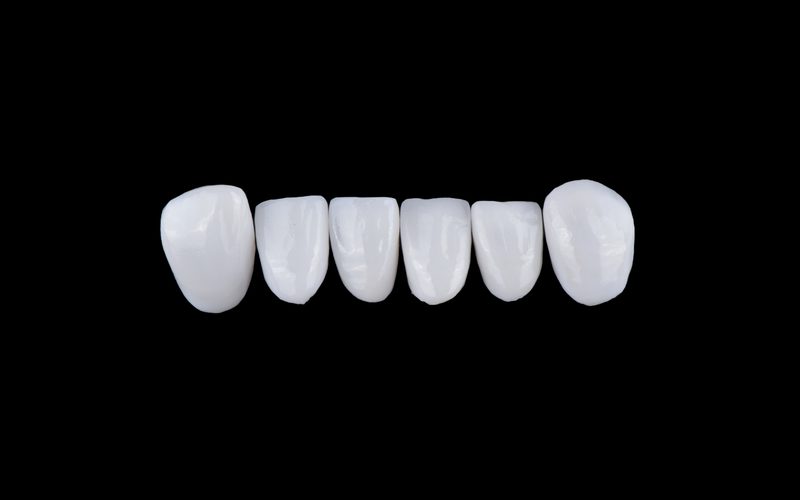 Porcelain crowns crafted for a natural, seamless fit